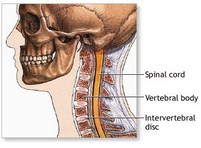 West Hollywood Neck Pain